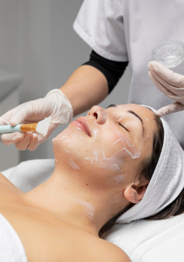 Imagem ilustrativa do tratamento Peeling Químico